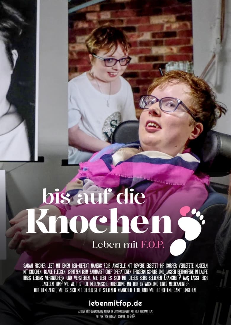 Bis auf die Knochen - Leben mit FOP